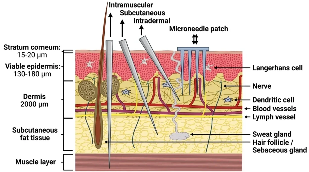 Immunological Precision: Microneedles deliberately target the shallow epidermis, which is dense with antigen-presenting Langerhans cells, enabling significant dose-sparing..